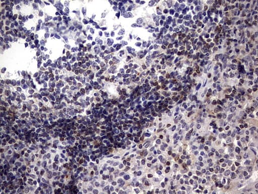 BCL2 / Bcl-2 Antibody (clone OTI2E5)