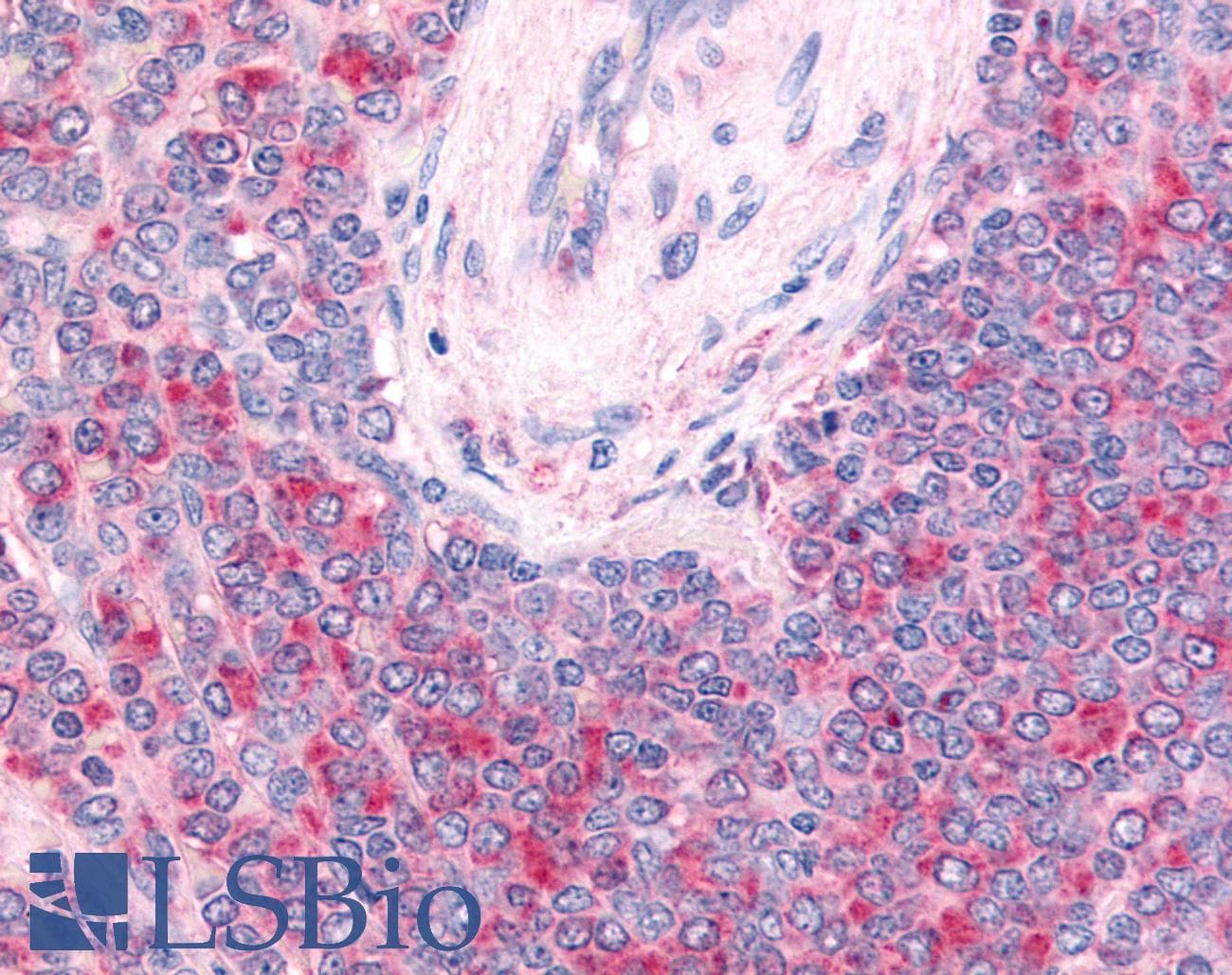 PathPlus™ Polyclonal Rabbit anti-Human c-Kit / CD117 Antibody (Extracellular Domain, IHC)