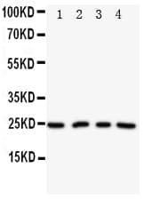 Polyclonal Rabbit anti-Human NPM2 Antibody (aa25-43, WB)