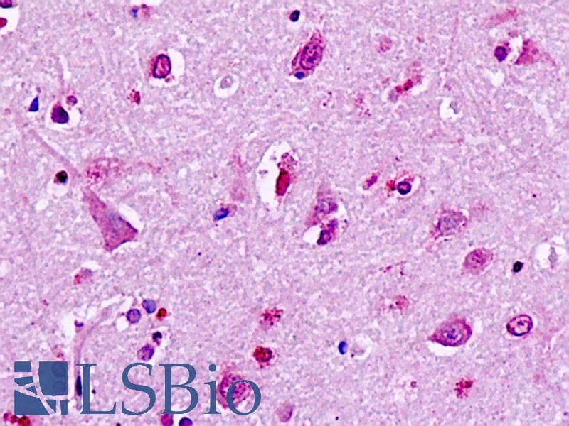 PathPlus™ Polyclonal Rabbit anti-Human GPR49 / LGR5 Antibody (Cytoplasmic Domain, IHC)