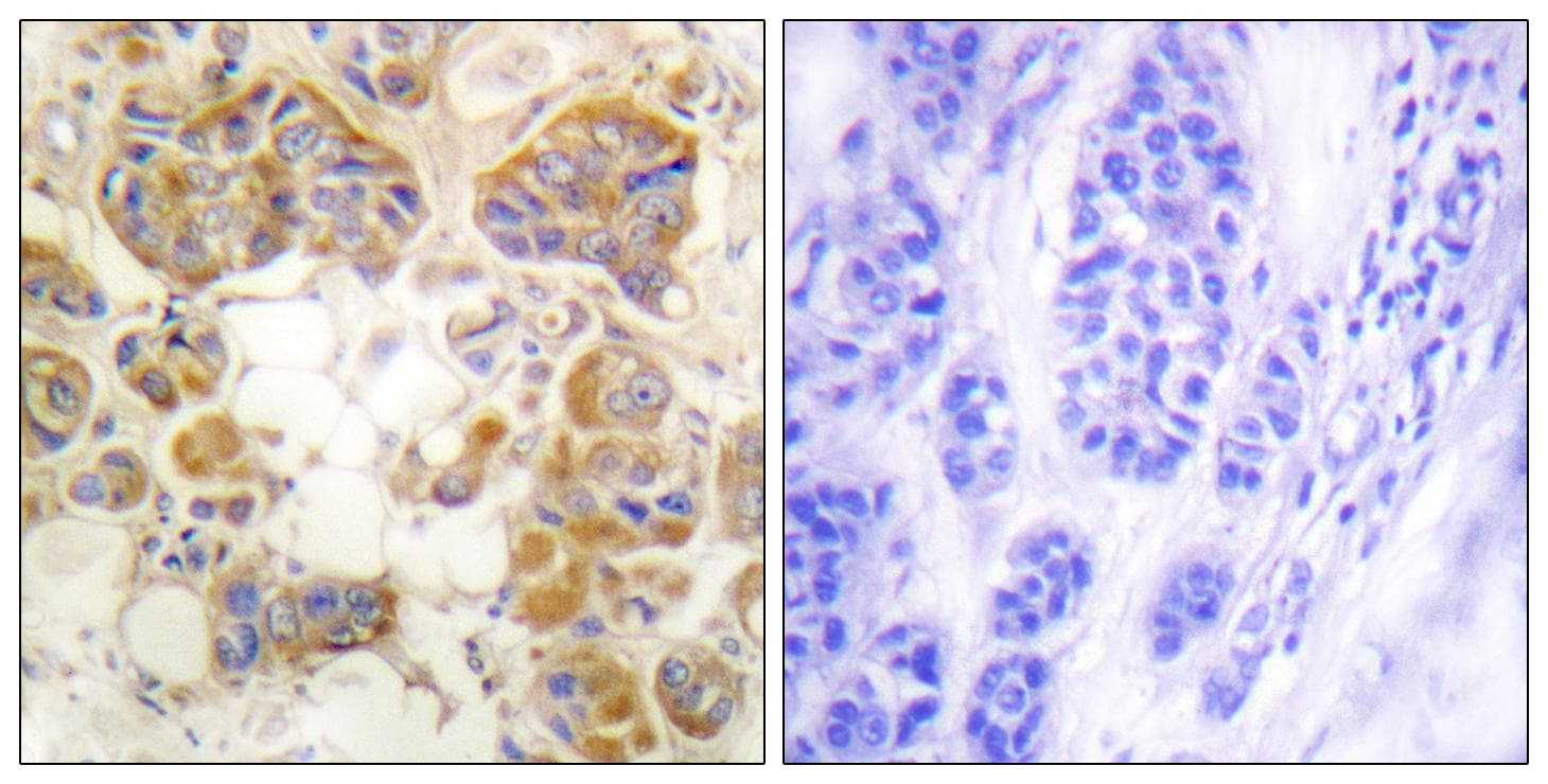 Collagen I Antibody