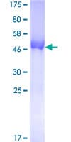 Human UROS Protein (Recombinant GST)