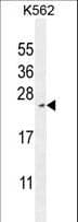 RTP4 / IFRG28 Antibody (aa186-215)