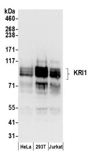 Polyclonal Rabbit anti-Human KRI1 Antibody (aa200-250, WB)