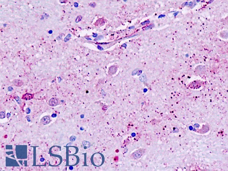IHC-plus™ GPR162 Antibody (Transmembrane Domain)