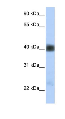SGCB / SGC / Sarcoglycan Beta Antibody (aa180-229)
