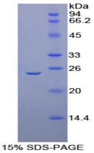Human AMBP Protein (Recombinant His)