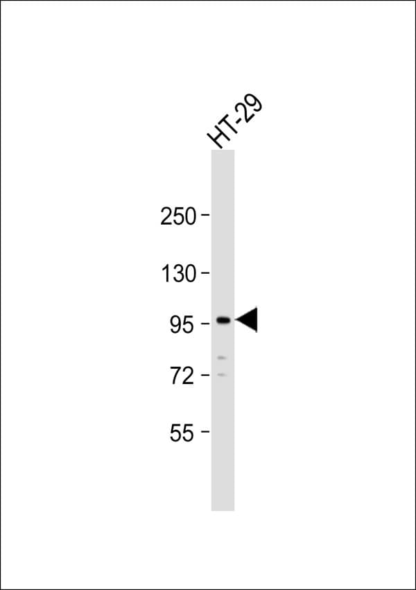 Polyclonal Rabbit anti-Human FES Antibody (WB)