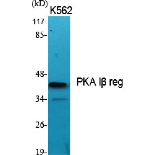 Polyclonal Rabbit anti-Human PRKAR1B Antibody (80-160 aa, Internal, IHC, WB)