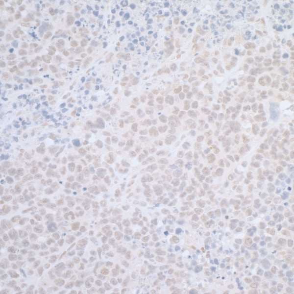 ELAC2 Antibody (aa150-200)