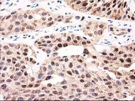GALE / UDP-Glucose 4-Epimerase Antibody (clone OTI1C4)