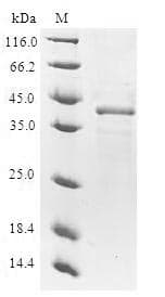 Human ODC1 / Ornithine Decarboxylase Protein (Recombinant 10His-SUMO, N-terminus + Myc, C-terminus)