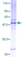 Human ZDHHC7 Protein (Recombinant GST)