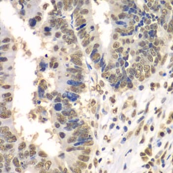 Polyclonal Rabbit anti-Human HDAC2 Antibody (IHC, IF, WB)