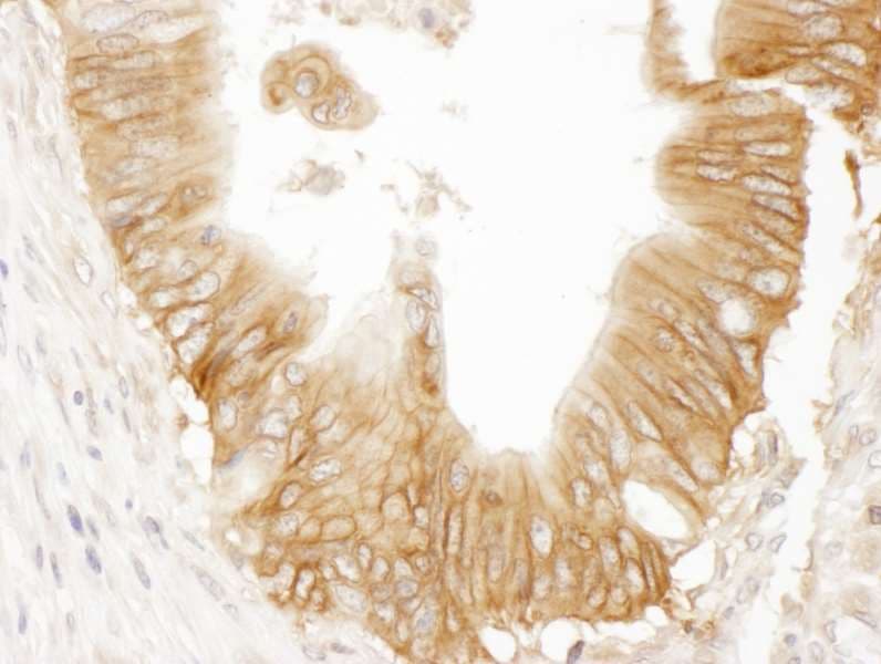 ADCY9 / Adenylate Cyclase 9 Antibody (aa1303-1353)