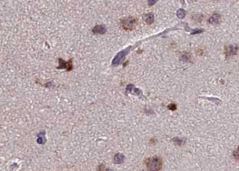 PRKCZ / PKC-Zeta Antibody (phospho-Thr410)