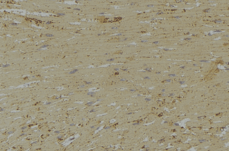 CALD1 / Caldesmon Antibody