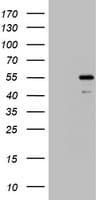 TIPIN Antibody (clone OTI3A1)