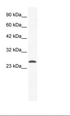 CACNG6 Antibody (aa22-71, FITC)