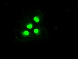 TRIM33 / TIF1-Gamma Antibody (clone OTI6B7)