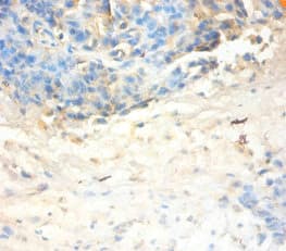 SLPI / Antileukoproteinase Antibody