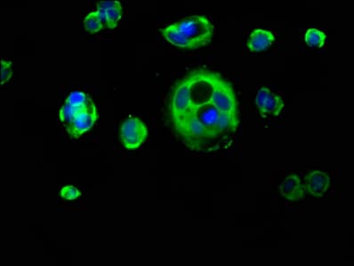 KRT1 / CK1 / Cytokeratin 1 Antibody