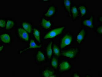 ABCC3 / MRP3 Antibody