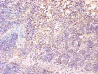 FTL / Ferritin Light Chain Antibody