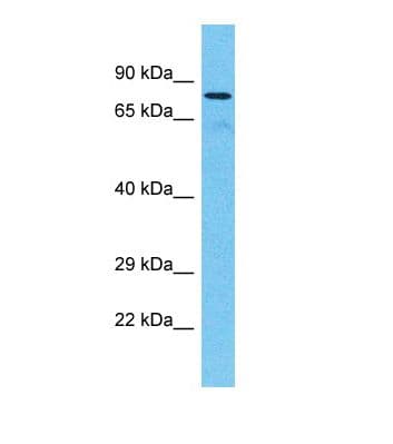 TTC30A Antibody (aa524-573)