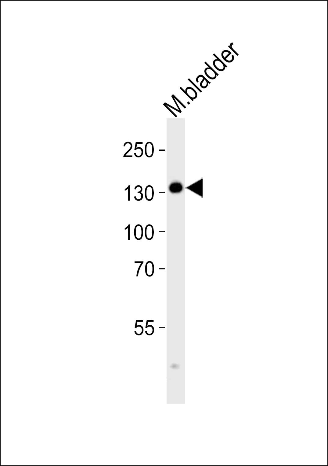 Polyclonal Rabbit anti-Human MYLK Antibody (aa923-953, IHC, WB)