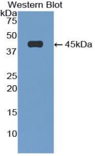 GFAP Antibody (aa108-211)