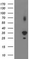 Monoclonal Mouse anti-Human PLEKHA3 Antibody (clone OTI5D11, IHC, IF, WB)