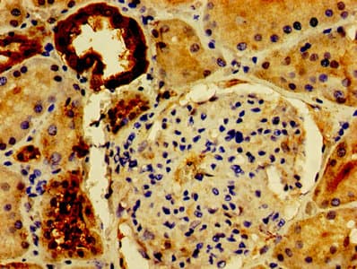 PVALB / Parvalbumin Antibody (aa2-110)