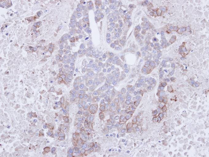 BTLA / CD272 Antibody (aa1-164)