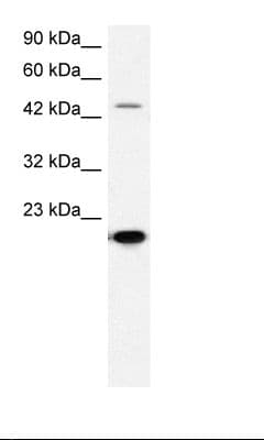 MMP19 Antibody (aa349-398)