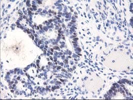 UNG / Uracil DNA Glycosylase Antibody (clone OTI1A11)
