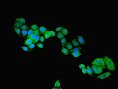 C9orf72 / ALSFTD Antibody