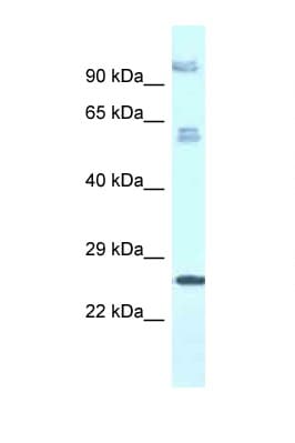 TMEM222 Antibody (aa106-155)