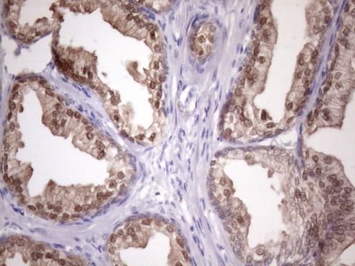 Vps60 / CHMP5 Antibody (clone OTI5C7)