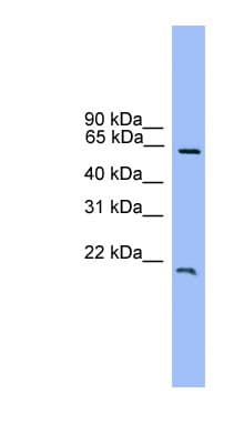 DACH / DACH1 Antibody (C-Terminus)