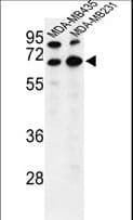 Polyclonal Rabbit anti-Human BEST2 / Bestrophin-2 Antibody (aa374-403, IHC, WB)