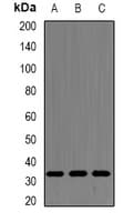 Polyclonal Rabbit anti-Human SRSF1 / SF2 Antibody (IHC, IF, WB)