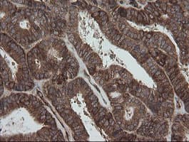 ROMO1 Antibody (clone OTI2C12)