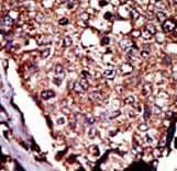 DGKB / DGK Beta Antibody (aa773-804)