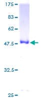 Human UBCH / UBE2H Protein (Recombinant GST)