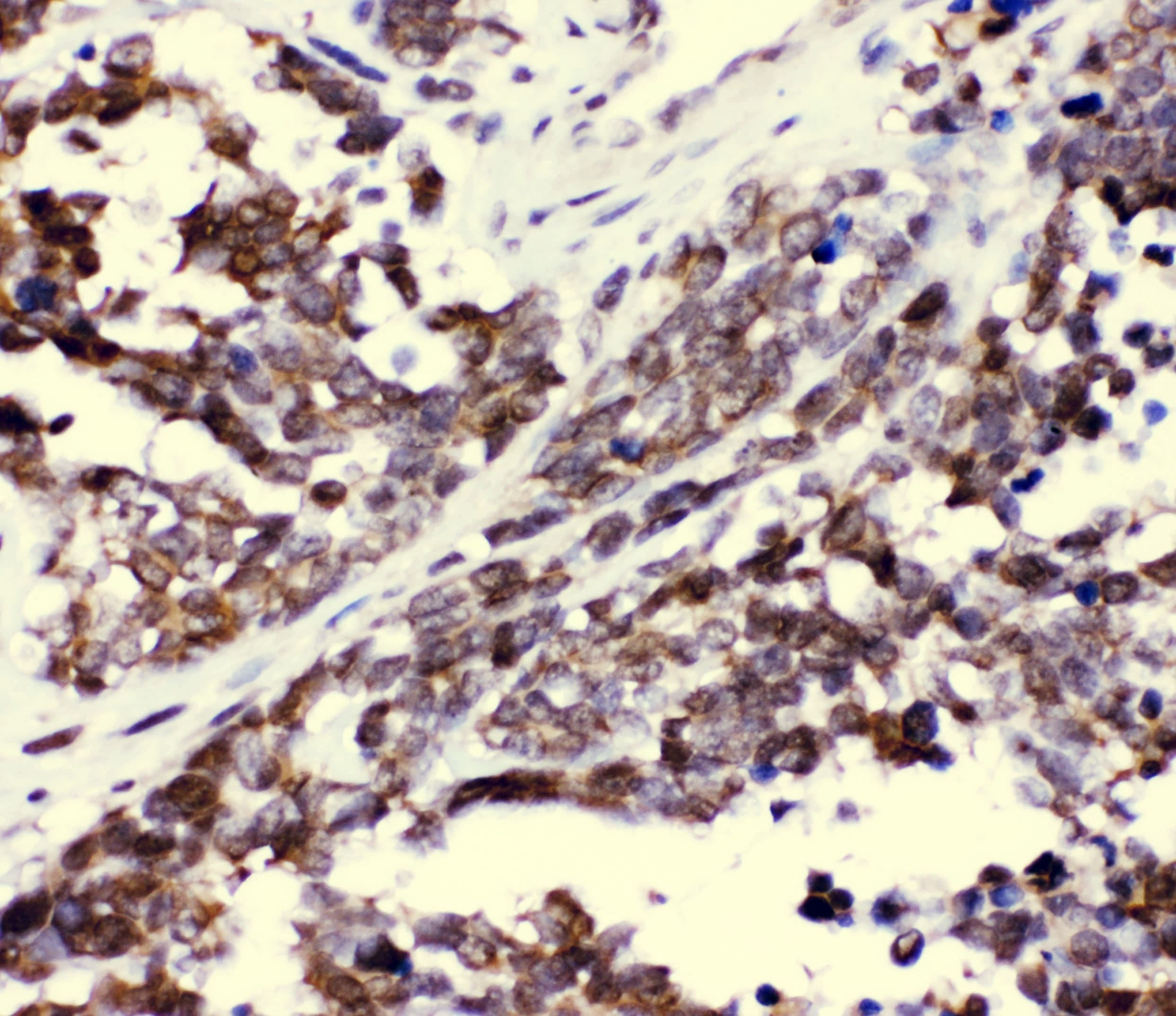Polyclonal Rabbit anti-Human CCT3 Antibody (IHC, WB)