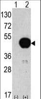 APG4B / ATG4B Antibody (aa358-390)