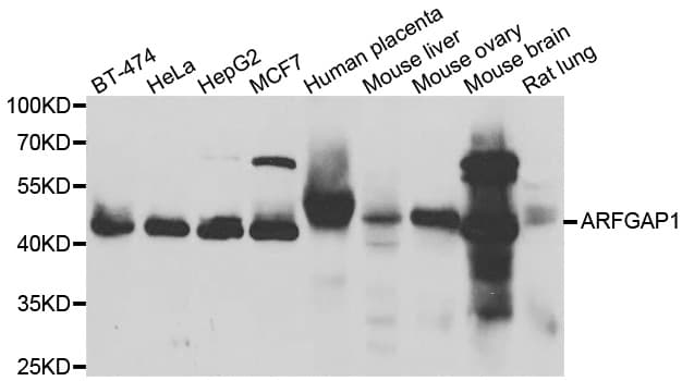 Polyclonal Rabbit anti-Human ARFGAP1 Antibody (IHC, IF, WB)