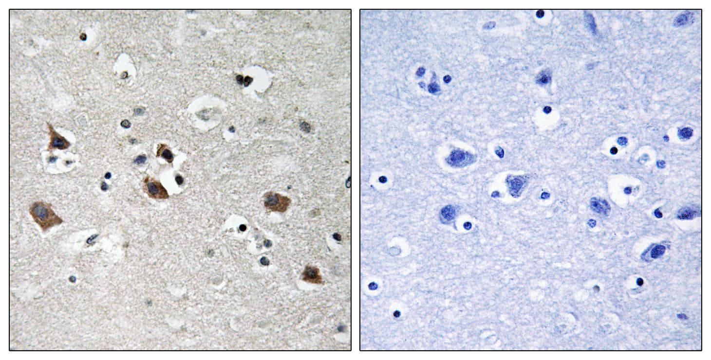 LCP2 / SLP-76 Antibody (phospho-Tyr128)