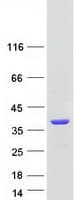 Human TS / Thymidylate Synthase Protein (Recombinant Myc-DDK (Flag))